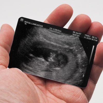 New Baby Scan Wallet Photo Card Custom Metal Wallet Picture Keepsake Gift for Baby Shower Purse Photo Personalised Baby Scan Picture